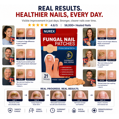 Nurex® Fungal Nail Removal Patches
